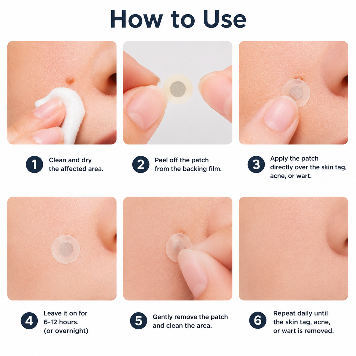 ?Muwix®2-in-1 Microneedle & Hydrocolloid Patch?| Removes Raised Moles, Acne, Flat Warts & Skin Tags | Helps Improve Wrinkles, Scars & Blemishes | Invisible Patches for Face & Body
