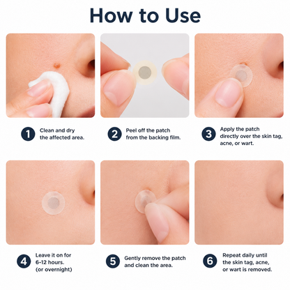 ✨✨Muwix®2-in-1 Microneedle & Hydrocolloid Patch?| Removes Raised Moles, Acne, Flat Warts & Skin Tags | Helps Improve Wrinkles, Scars & Blemishes | Invisible Patches for Face & Body