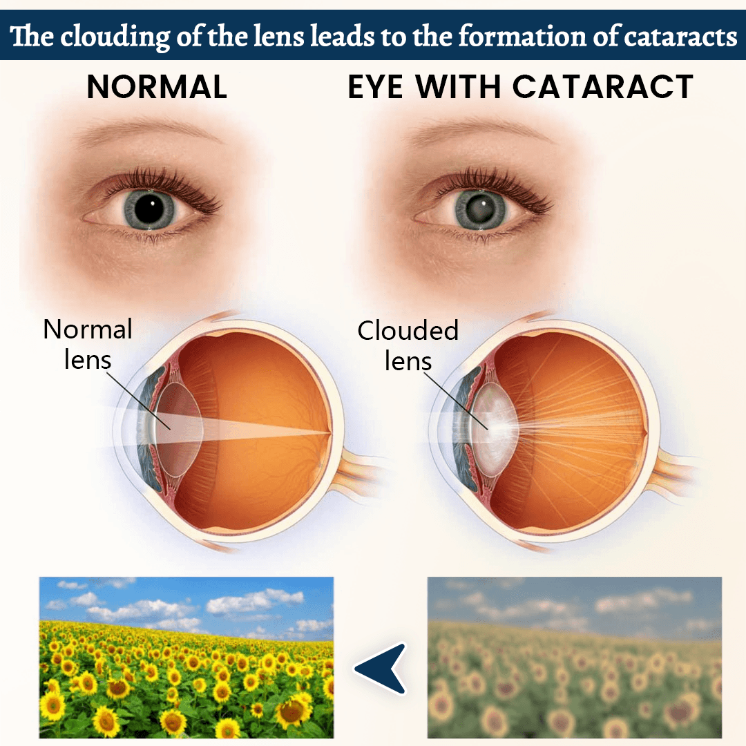 Neslemy Daily Vision Support Eye Patch